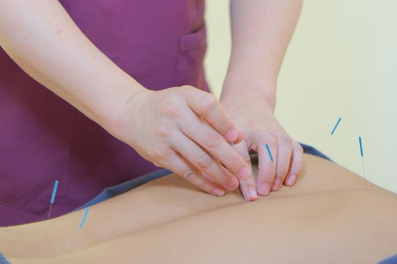 背中への鍼施術を行う様子|安泰漢方鍼灸院(葛飾区青砥)