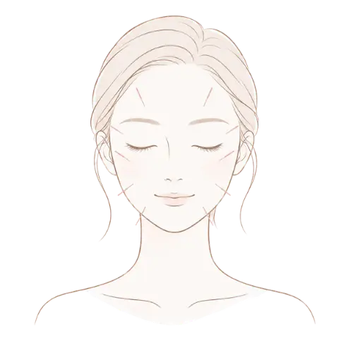 顔のみ美容鍼の女性イラスト
